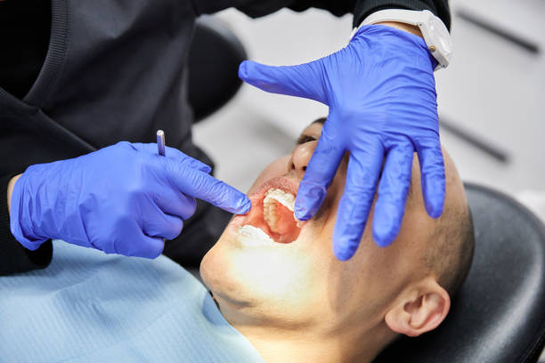 Best Emergency Dentist for Lost Fillings or Crowns in Modesto, CA